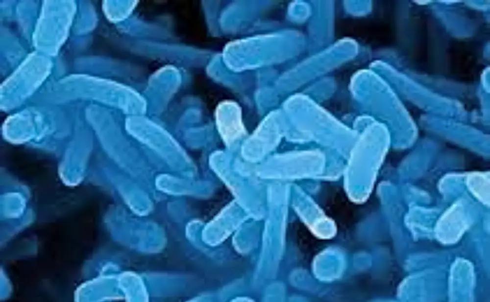 Beneficial Bacteria — Zoomed in photo of Nitrobacter bacteria found in aquariums